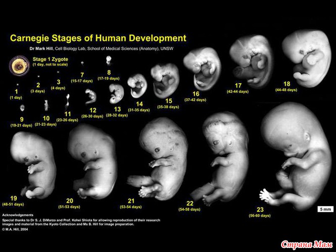 На рисунке изображен эмбрион человека в разный период времени какое свойство живых систем