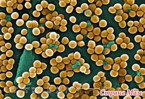   (Staphylococcus aureus)