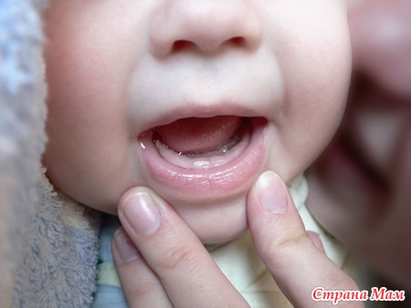 Симптомы прорезывания молочных зубов у младенцев и способы их облегчения