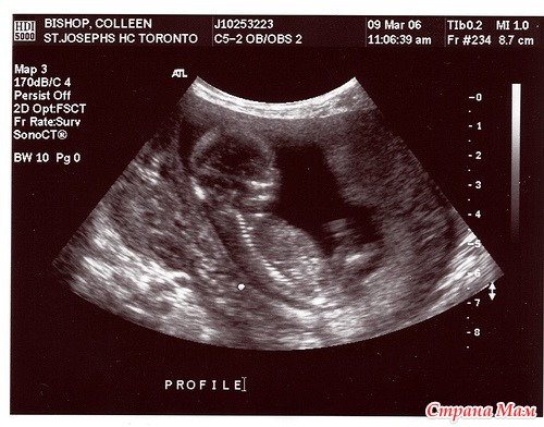 Беременность 16 Недель Мальчик Фото
