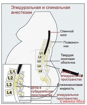 ����������� ������������ ���������