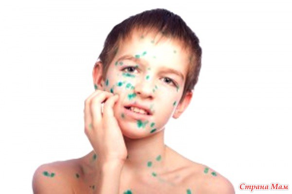 Карантин по ветрянке в классе. Объясните?! - Страна Мам