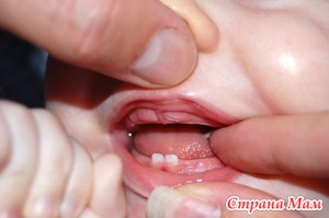 Прорезывание зубов у детей: что важно?