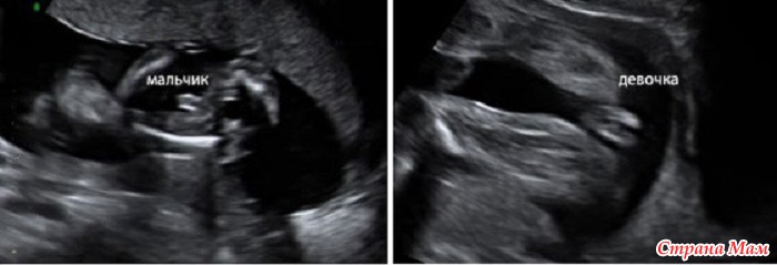 23 неделя беременности: узи плода на 23 неделе