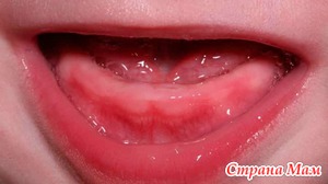 Особенности прорезывания зубов у малышей